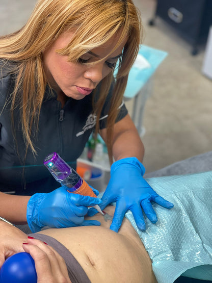 Undo Non-Laser Tattoo Removal Hands-On Training Deposit